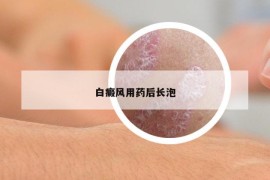 白癜风用药后长泡