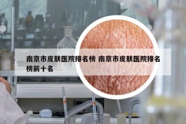 南京市皮肤医院排名榜 南京市皮肤医院排名榜前十名