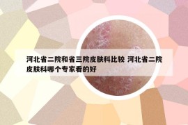 河北省二院和省三院皮肤科比较 河北省二院皮肤科哪个专家看的好