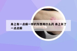 身上有一点癣一样的东西用什么药 身上长了一点点癣