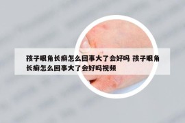 孩子眼角长癣怎么回事大了会好吗 孩子眼角长癣怎么回事大了会好吗视频