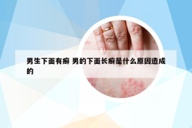 男生下面有癣 男的下面长癣是什么原因造成的