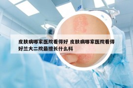 皮肤病哪家医院看得好 皮肤病哪家医院看得好兰大二院最擅长什么科