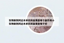 生物制剂阿达木单抗和益赛普哪个副作用小 生物制剂阿达木单抗和益赛普哪个好