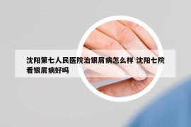 沈阳第七人民医院治银屑病怎么样 沈阳七院看银屑病好吗