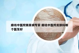 廊坊中医院银屑病专家 廊坊中医院皮肤科哪个医生好