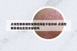 点滴型银屑病恢复期结痂能不能扣掉 点滴型银屑病治愈后会留疤吗