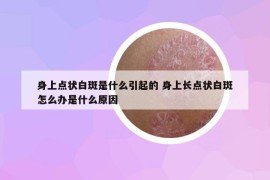 身上点状白斑是什么引起的 身上长点状白斑怎么办是什么原因