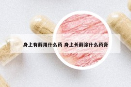 身上有藓用什么药 身上长藓涂什么药膏