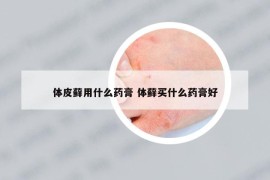 体皮藓用什么药膏 体藓买什么药膏好