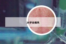 26岁白癜风