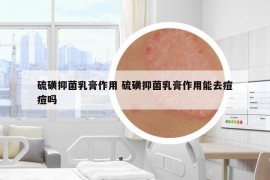 硫磺抑菌乳膏作用 硫磺抑菌乳膏作用能去痘痘吗