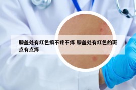 膝盖处有红色癣不疼不痒 膝盖处有红色的斑点有点痒