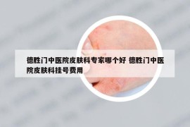 德胜门中医院皮肤科专家哪个好 德胜门中医院皮肤科挂号费用