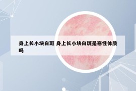 身上长小块白斑 身上长小块白斑是寒性体质吗