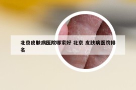 北京皮肤病医院哪家好 北京 皮肤病医院排名