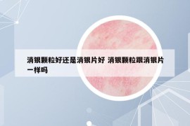 消银颗粒好还是消银片好 消银颗粒跟消银片一样吗