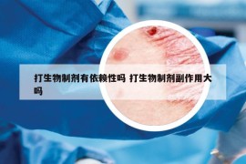 打生物制剂有依赖性吗 打生物制剂副作用大吗