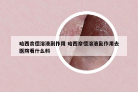 哈西奈德溶液副作用 哈西奈德溶液副作用去医院看什么科