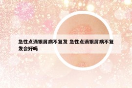 急性点滴银屑病不复发 急性点滴银屑病不复发会好吗