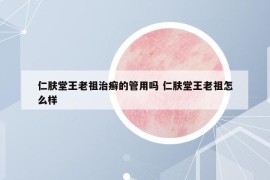 仁肤堂王老祖治癣的管用吗 仁肤堂王老祖怎么样