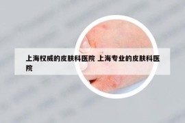 上海权威的皮肤科医院 上海专业的皮肤科医院