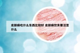 皮肤癣吃什么东西比较好 皮肤癣饮食要注意什么