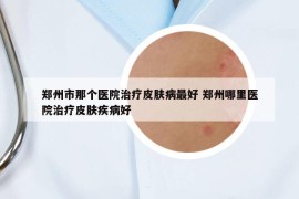 郑州市那个医院治疗皮肤病最好 郑州哪里医院治疗皮肤疾病好