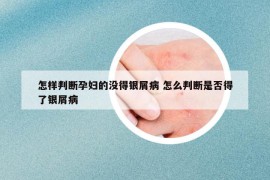 怎样判断孕妇的没得银屑病 怎么判断是否得了银屑病