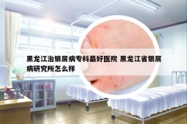 黑龙江治银屑病专科最好医院 黑龙江省银屑病研究所怎么样