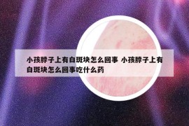 小孩脖子上有白斑块怎么回事 小孩脖子上有白斑块怎么回事吃什么药