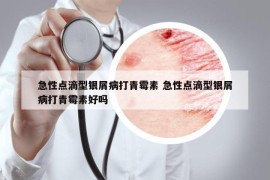 急性点滴型银屑病打青霉素 急性点滴型银屑病打青霉素好吗