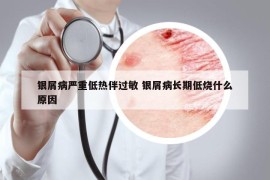 银屑病严重低热伴过敏 银屑病长期低烧什么原因