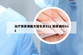 治疗银屑病偏方维生素B12 银屑病吃b12