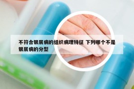 不符合银屑病的组织病理特征 下列哪个不是银屑病的分型