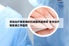 贵阳治疗银屑病的权威医院是哪家 贵州治疗银屑病三甲医院