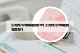 东莞博润白癫疯医院好吗 东莞博润白斑医院百度百科