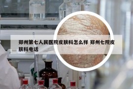 郑州第七人民医院皮肤科怎么样 郑州七院皮肤科电话