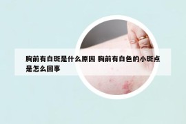 胸前有白斑是什么原因 胸前有白色的小斑点是怎么回事