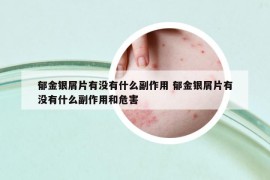 郁金银屑片有没有什么副作用 郁金银屑片有没有什么副作用和危害