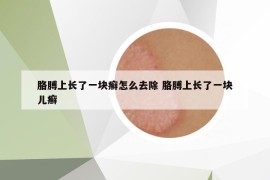 胳膊上长了一块癣怎么去除 胳膊上长了一块儿癣