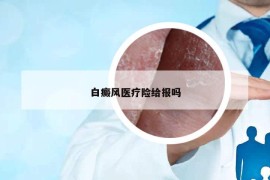 白癜风医疗险给报吗