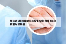 维生素E软胶囊给可以知牛皮癣 维生素e软胶囊对银屑病