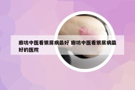 廊坊中医看银屑病最好 廊坊中医看银屑病最好的医院