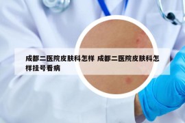 成都二医院皮肤科怎样 成都二医院皮肤科怎样挂号看病