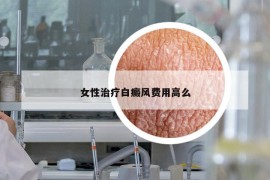 女性治疗白癜风费用高么