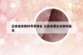 云南省皮肤科专家排名 云南省著名皮肤科医生