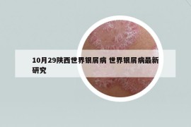 10月29陕西世界银屑病 世界银屑病最新研究