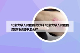 北京大学人民医院皮肤科 北京大学人民医院皮肤科张建中怎么样