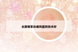 太原哪家白癜风医院技术好